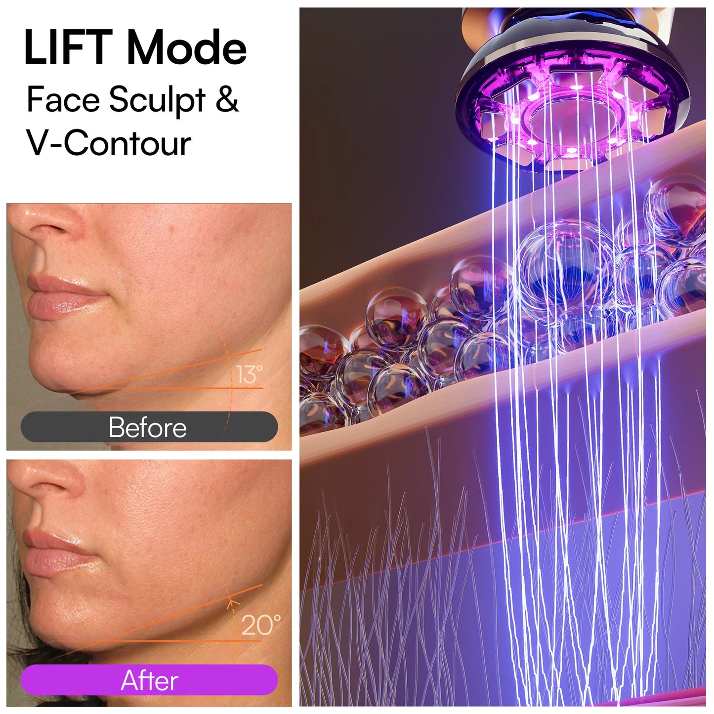 A Science-Backed Solution That Actually Works: The Lift + Tighten + Infuse System
