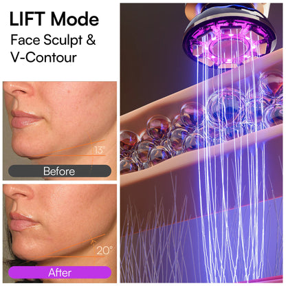 A Science-Backed Solution That Actually Works: The Lift + Tighten + Infuse System